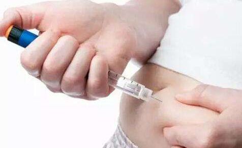 南京推薦雙眼皮手術好的頂級醫(yī)院是哪家