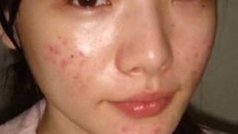 北京眼科醫(yī)院排名榜單揭曉，何氏、同仁入選！附近視眼手術費用一覽