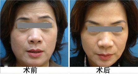 常州哪家唇部整形醫(yī)院值得信賴，價格如何？