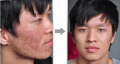 濟(jì)南高新麥昆醫(yī)療美容診所的價(jià)格如何？真實(shí)技術(shù)測(cè)評(píng)與大揭秘