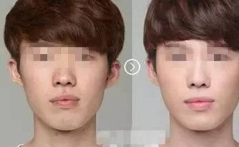 2024年洛陽(yáng)市排名前十的整形醫(yī)院綜合排行榜