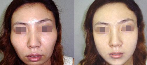 廣州五家口碑俱佳的整形醫(yī)院怎么選