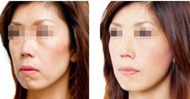 【2024年】北京治療疤痕的權威醫(yī)院TOP3推薦