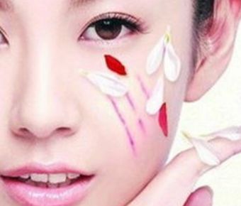 南通哪家醫(yī)院能夠有效改善嘴角開大問題？