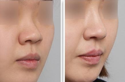 深圳整形醫(yī)院實(shí)力盤點(diǎn)！最受用戶歡迎的醫(yī)院排行榜揭曉