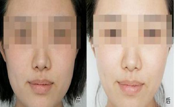 長(zhǎng)沙市哪家整形醫(yī)院好