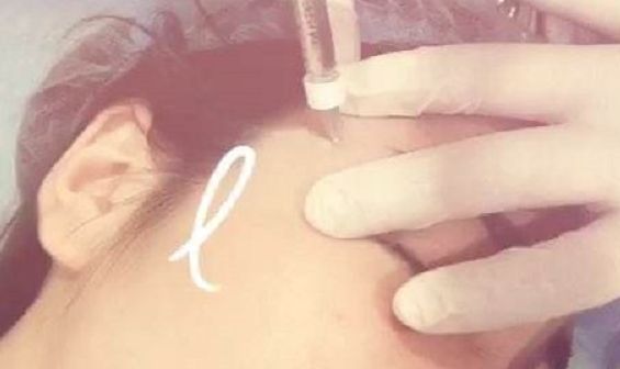 深圳前海地區(qū)哪家整形醫(yī)院比較靠譜？好的深圳整容醫(yī)院有哪些？