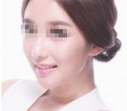 2024年太原頂級整形醫(yī)院排名曝光，專家評選出的前10強！