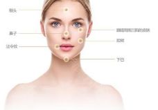 金華哪家醫(yī)院割雙眼皮好 三甲醫(yī)院推薦