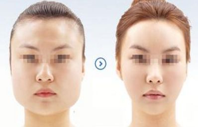 2024年溫州哪家醫(yī)院的整形美容效果最佳？