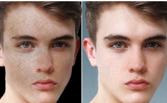 深圳哪里可以有效改善額頭問題，專業(yè)治療推薦