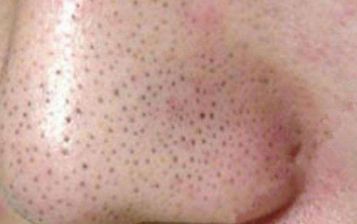 天津割雙眼皮的好醫(yī)院選哪家