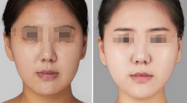 2024年惠州哪些整形醫(yī)院口碑好？