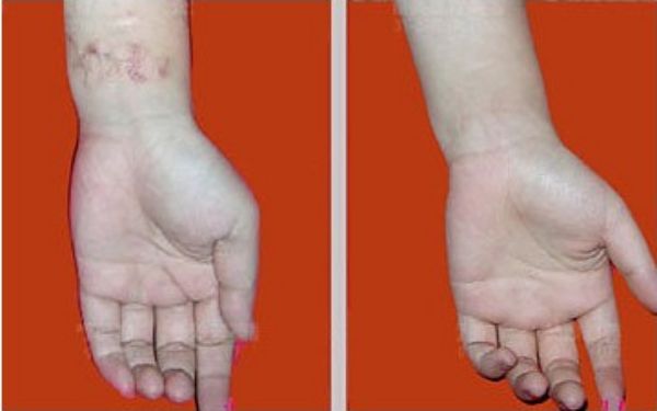 【雙眼皮專家駕到！武漢中翰整形醫(yī)院付毅院長親診雕刻美眼】