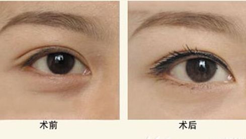 樂山人民醫(yī)院醫(yī)生特色項目與服務評價全解析