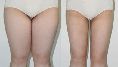 天津口腔整形醫(yī)院推薦，去除笑露齦的好選擇