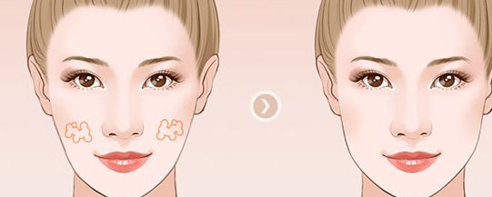 濟南整形醫(yī)院推薦：權威醫(yī)院排名及口碑比較