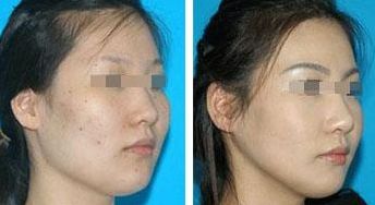 上海優(yōu)質(zhì)美容醫(yī)院盛行，曙光醫(yī)院和長海醫(yī)院卓越實(shí)力受矚目！速來查看！