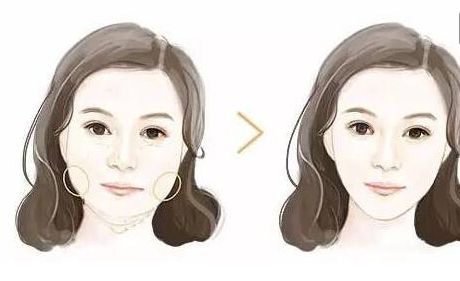 2024年最佳匯總！惠州哪家整形醫(yī)院專業(yè)祛法令紋？