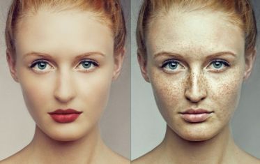 昆明三甲醫(yī)院激光美容推薦TOP5，解析裝修比較好的臨床醫(yī)生一線分享