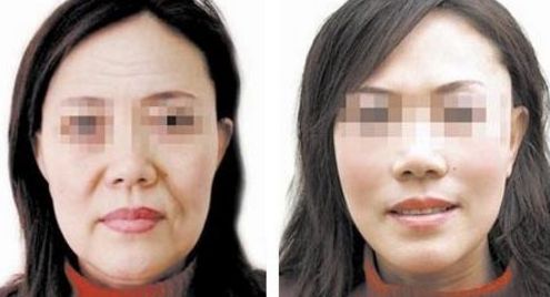 洛陽整容醫(yī)院排名與評價