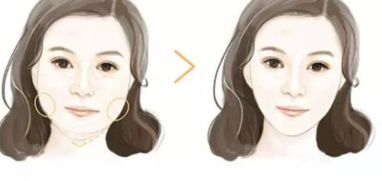 大連市哪些醫(yī)院是專業(yè)的開眼角整形中心？