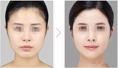 武漢治療色斑好的醫(yī)院推薦，哪家效果好呢？