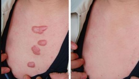 北京有哪些三甲級(jí)美容醫(yī)院？