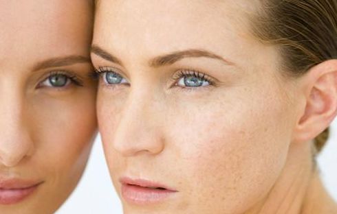 濟南哪家醫(yī)院做雙眼皮效果好