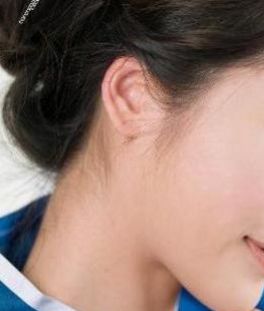 成都哪個醫(yī)院做耳朵整形效果好？