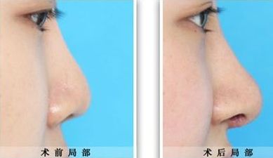 臨汾臻容醫(yī)療美容門診部詳解：技術水平、服務項目與價格清單