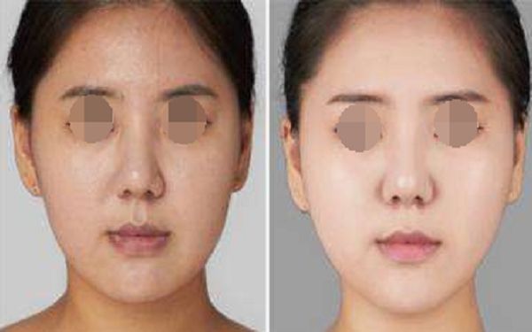 珠海博愛女子醫(yī)院整形外科項(xiàng)目全新推出，項(xiàng)目大揭秘