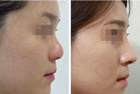 2024年南昌市下巴整形醫(yī)院綜合評(píng)價(jià)曝光