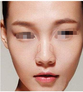 泉州哪些醫(yī)院可以信賴進(jìn)行整形手術(shù)？