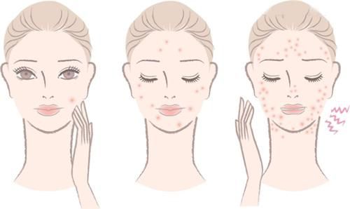 西安正頜整形醫(yī)院推薦：2024年國際醫(yī)學(xué)中心正頜手術(shù)價(jià)目表