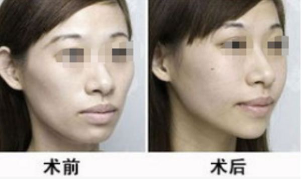 湖北地區(qū)整形醫(yī)院評(píng)選榜單，醫(yī)術(shù)高超排名靠前的醫(yī)療機(jī)構(gòu)