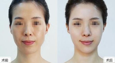 深圳美萊整形醫(yī)院位置介紹，牽手醫(yī)生，搶先體驗熱門項目