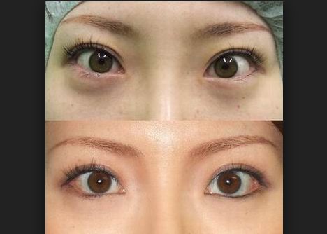 成都吸脂哪家醫(yī)院做得比較好