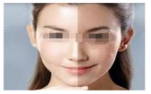 伊妍仕與儒白天使少女針大比拼，優(yōu)劣一目了然