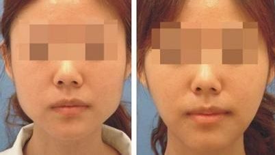 貴陽市眼部整形醫(yī)院排行榜