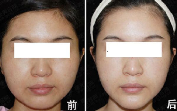 重慶市知名整形美容醫(yī)院榜單出爐！引領(lǐng)時(shí)尚潮流的醫(yī)療機(jī)構(gòu)盤(pán)點(diǎn)