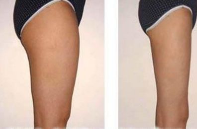 濰坊市十大優(yōu)質整形醫(yī)院推薦，網友評選領先榜單！