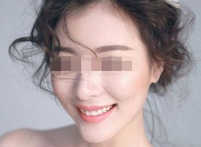 上海十大修復(fù)雙眼皮專(zhuān)家排行榜