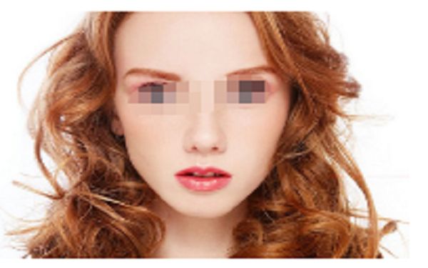 成都鼻部整形醫(yī)院排行榜前十，哪家技術(shù)最專業(yè)