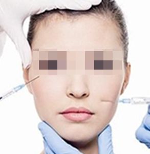 順產(chǎn)公司榜單排名，你一定要看的玻尿酸醫(yī)院選購指南！