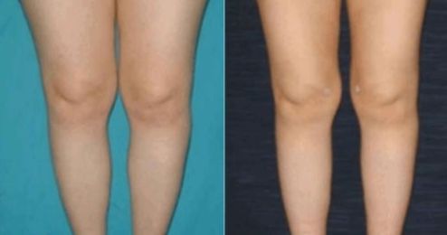 答案：  浙江哪個(gè)醫(yī)院的燒傷整形科醫(yī)護(hù)人員規(guī)模龐大？