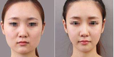 2024年北京八大處整形手術價格明細和推薦專家名錄