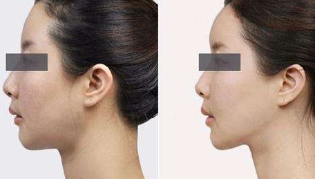 綿陽市哪家醫(yī)院整形效果好？整形醫(yī)院排名榜前十名出爐！