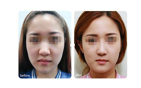 重慶最受歡迎的隆鼻醫(yī)院排行前八