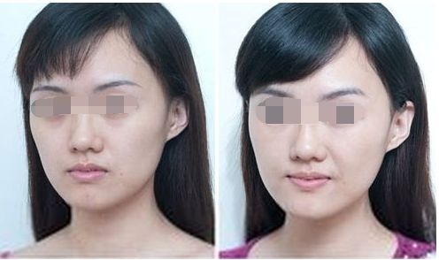 中山整形醫(yī)院八強(qiáng)名單公開！看看這些優(yōu)質(zhì)醫(yī)院是否入選受關(guān)注！